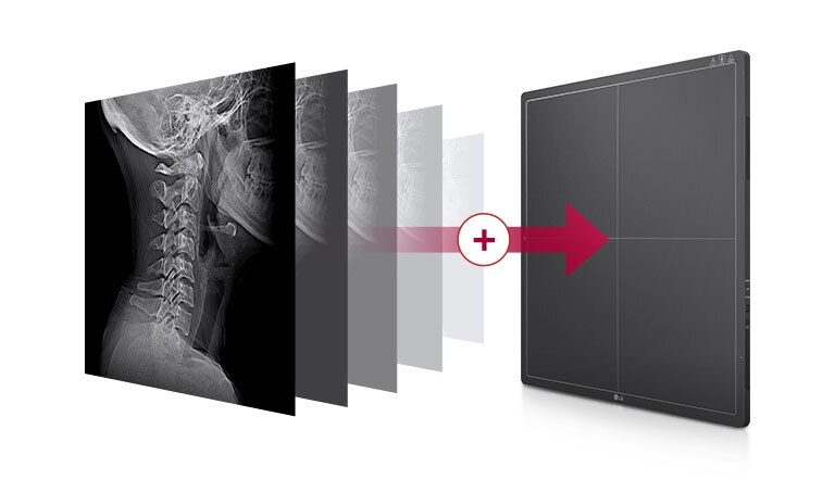 Una memoria incorporada que almacena automáticamente las imágenes tomadas en el detector, hasta 200 imágenes