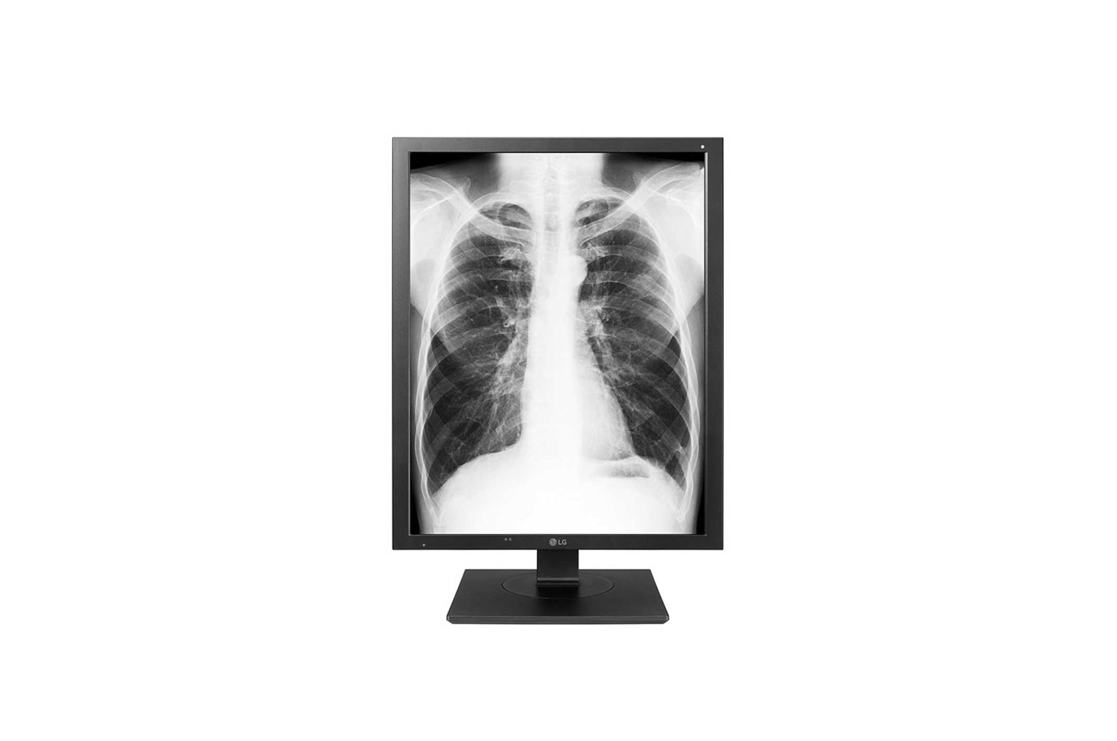 LG Monitor de diagnóstico LG de 3MP, 21HK512D-B