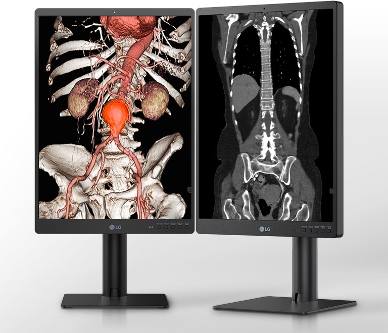 Monitor de Diagnóstico LG IPS 3MP de 21.3”