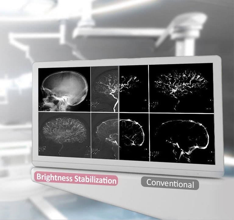 DICOM Parte 14 y estabilización de brillo