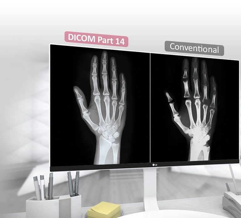 DICOM Part 14 Compatible1