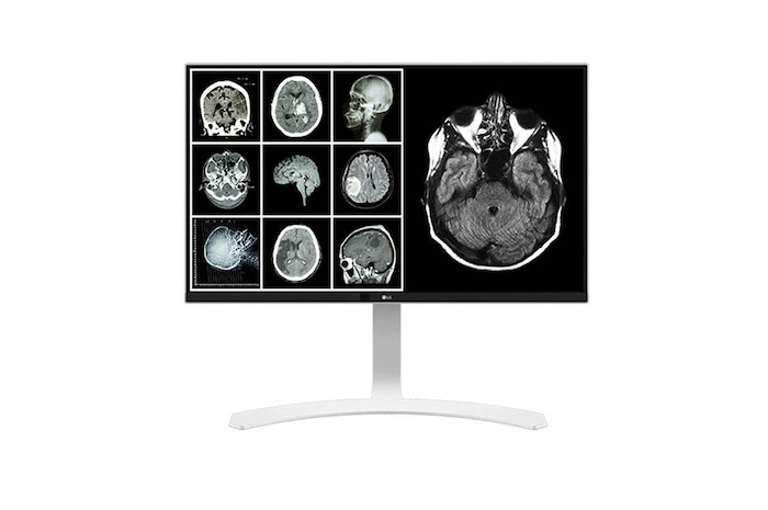LG Monitor de Revisión Clínica LG IPS 8MP, 27", estabilizador de brillo, 178º de ángulo de visión, 27HJ712C-W