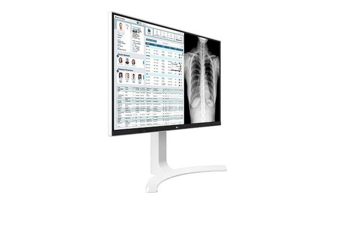 LG Monitor de Revisión Clínica LG IPS 8MP, 27", estabilizador de brillo, 178º de ángulo de visión, 27HJ712C-W