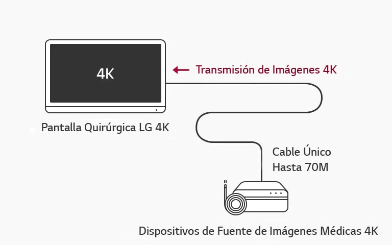 Soporte 12G-SDI: la pantalla quirúrgica LG 4K permite la transmisión a larga distancia de señales 4K a través de un solo cable coaxial sin latencia para una cirugía óptima.