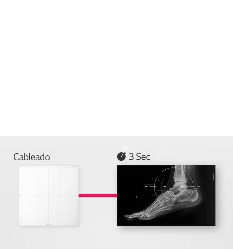 LG DXD incrementa productividad con un procesamiento rápido. Toma solo 3 segundo para obtener una imagen pura.