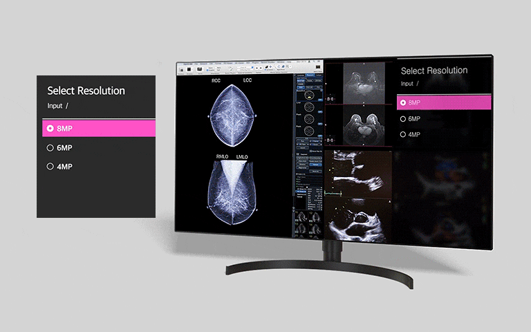 El modo multi-resolución ofrece a los usuarios la posibilidad de seleccionar la resolución entre 4MP, 6MP y 8MP.