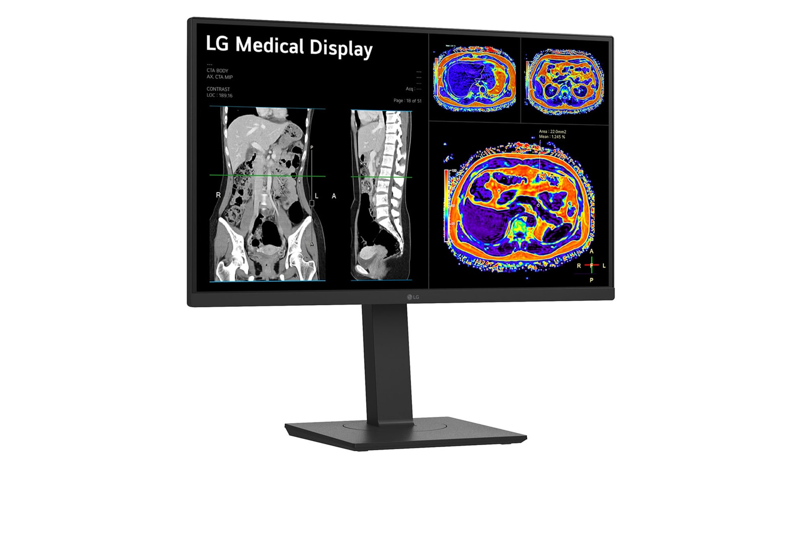 LG Monitor de revisión clínica 27", Panel IPS, 8MP, sensor de calibración desmontable, 178º Ángulo de Visión, 27HS713C-B