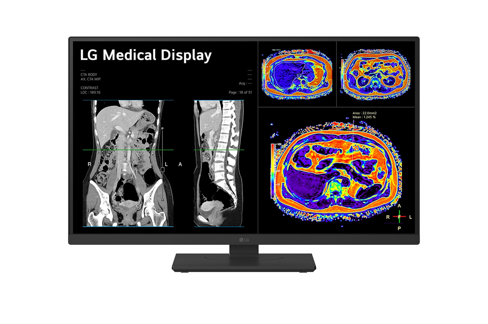 LG Monitor de revisión clínica 27", Panel IPS, 8MP, sensor de calibración desmontable, 178º Ángulo de Visión, 27HS713C-B
