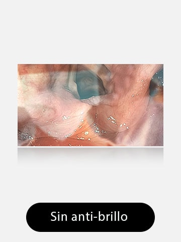 La imagen de la izquierda muestra un monitor sin antireflejo, donde los reflejos y brillos obstruyen la visión.