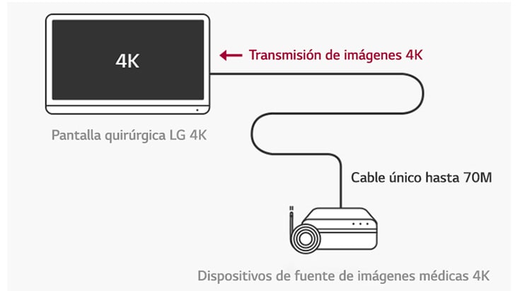 El monitor quirúrgico 4K dispone de HDR10 para mostrar las imágenes HDR de manera nítida.