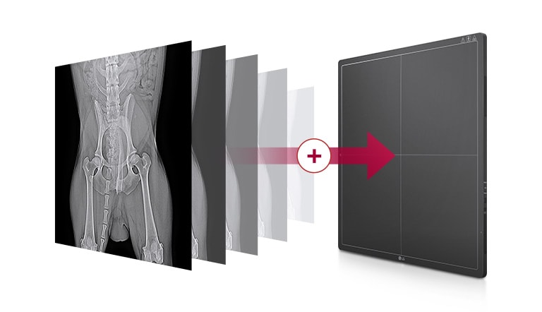 Mémoire intégrée stockant automatiquement les images prises sur le détecteur jusqu’à 200 images