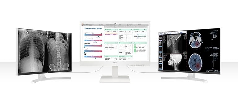 24cn670w permettant de connecter jusqu'à deux écrans de résolution uhd 4k