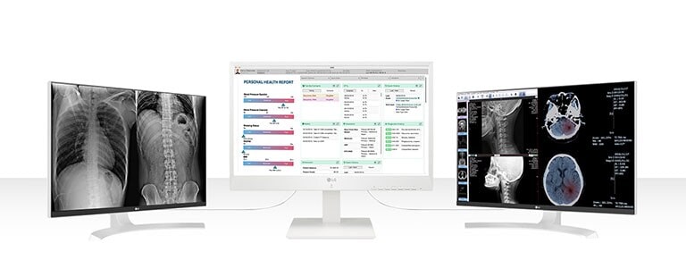 24cn670w permettant de connecter jusqu'à deux écrans de résolution uhd 4k