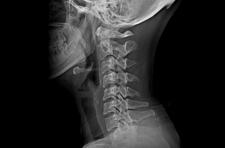 haute résolution et résultats clairs du diagnostic par imagerie en utilisant le LG DXD