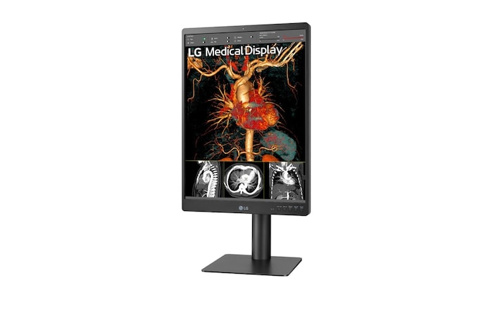 -15 degree side view