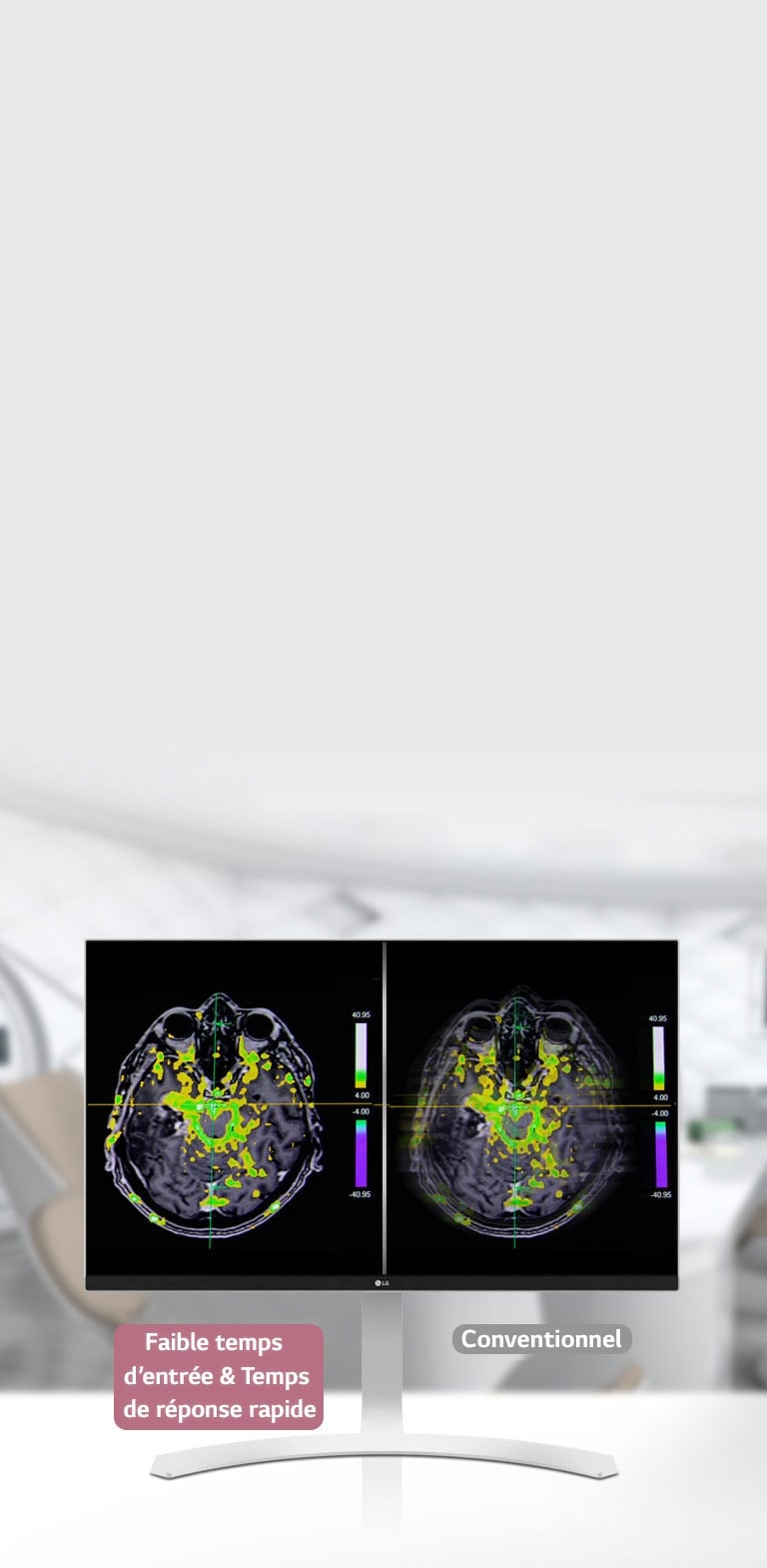 Mode Dynamic Sync et temps de réponse rapide <br>1