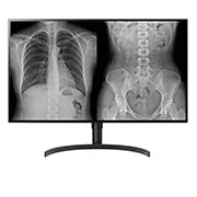 Vue avant de 31.5&#39;&#39; | Écran IPS format 16:9e | Résolution 8MP (3840 x 2160) LG 32HL512D-B