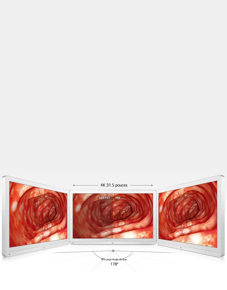 Précision Améliorée avec une Large Vue