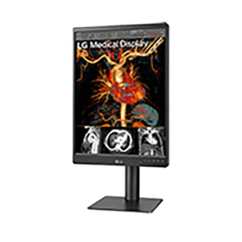 -15 degree side view