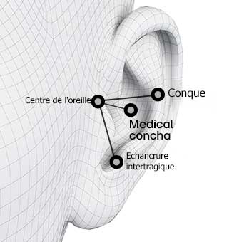 Rendu d'une oreille. Rendu d'une oreille avec trois points noirs et blancs pour montrer le repérage. Rendu d'une oreille avec l'écouteur à l'intérieur pour montrer l'adaptation virtuelle. Rendu d'une oreille avec des points noirs et des lignes pour montrer l'analyse ergonomique.