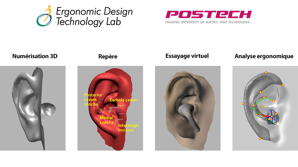 Une image dans laquelle l'image de modélisation de l'oreille en forme 3D est développée en 4 étapes au total.