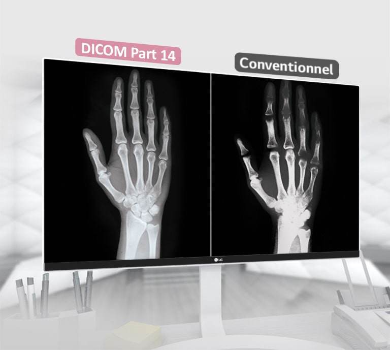 DICOM Partie 14 1