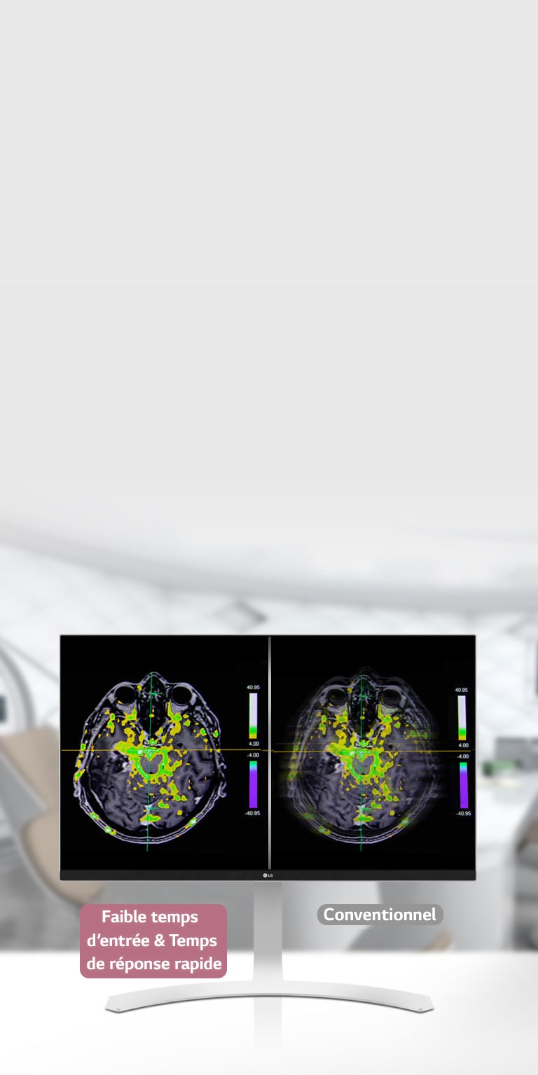 Mode Dynamic Sync et temps de réponse rapide 1