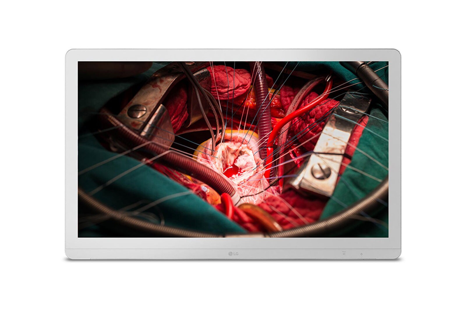 Vue avant de 27&#34; (68cm) | Écran IPS |Résolution UHD 3840 x 2160 LG 27HJ710S-W