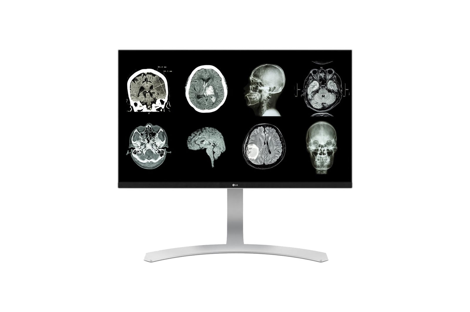 Vue avant de 27&#34; (68 cm) | Écran IPS | Résolution UHD 3840 x 2160 LG 27HJ712C-W