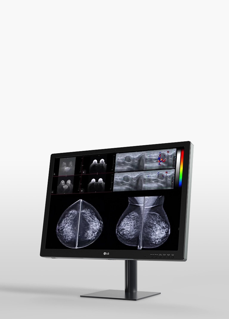 Moniteur de diagnostic LG de 31.5 pouces 8MP