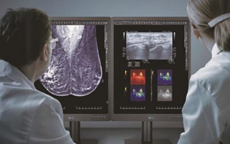 Doctor looking at images displayed on LG’s diagnostic monitor