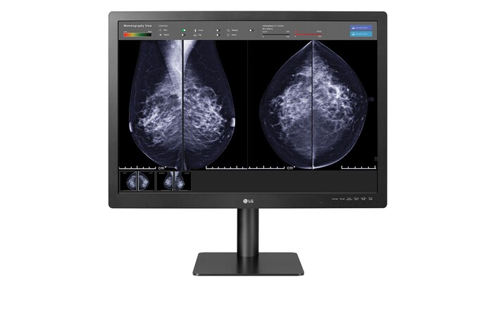 畫面顯示使用軟件查看乳房造影結果的 31HN713D 正視圖 