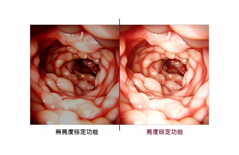 亮度穩定功能