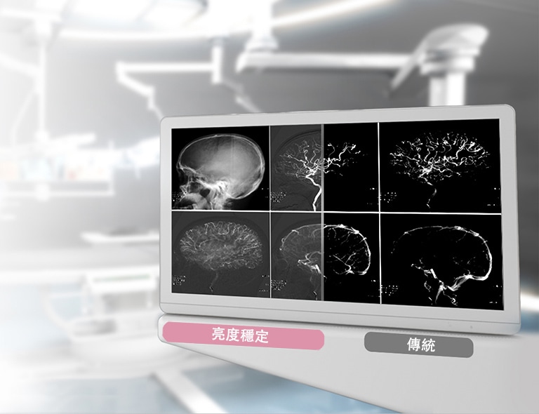 DICOM Part 14 和亮度穩定性