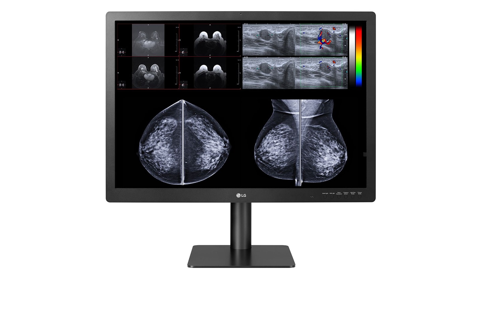 front view of 31HN713D with mammography imaging results on the screen 