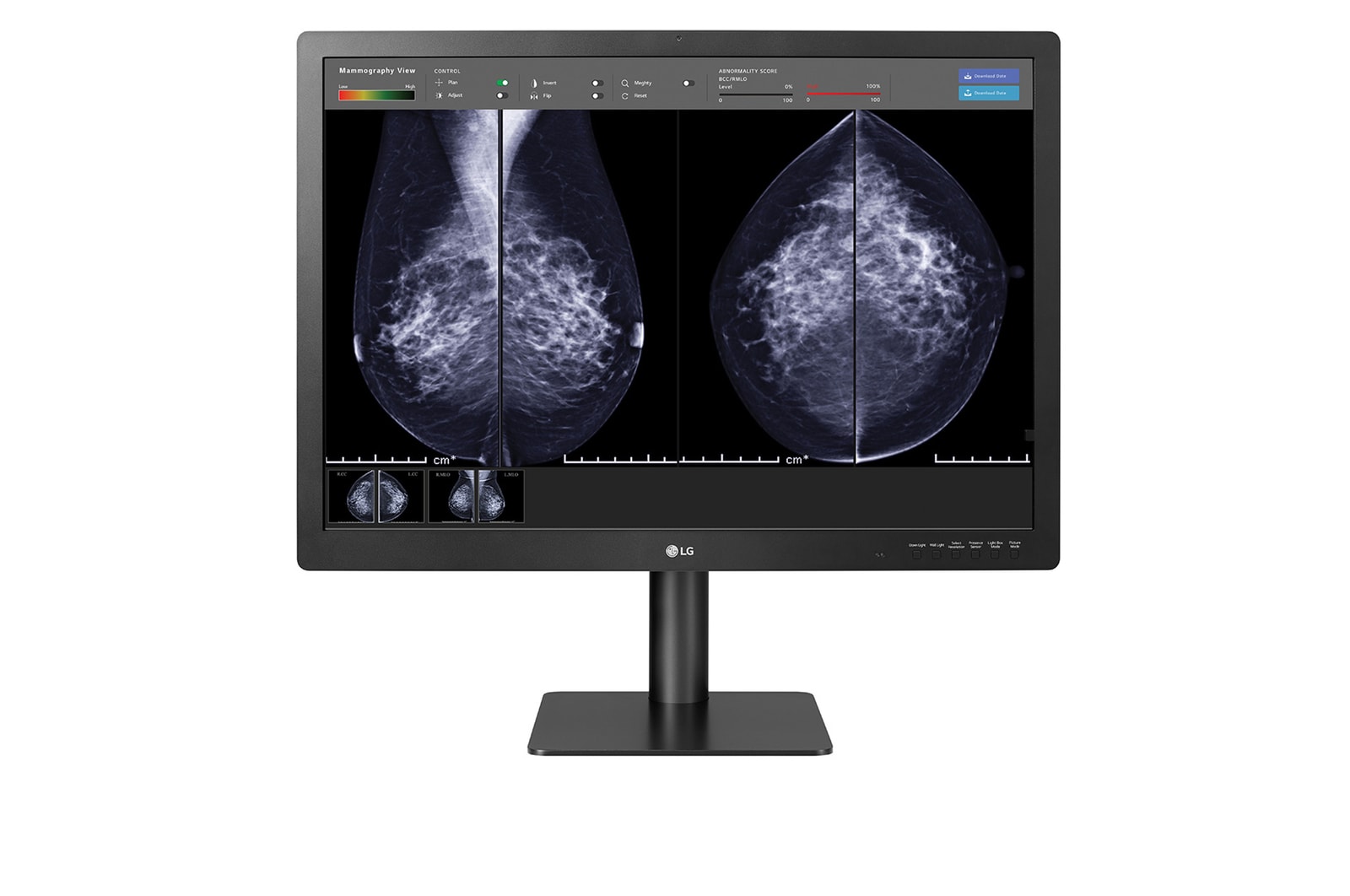 front view of 31HN713D with mammography imaging results viewed in a software program on the screen 