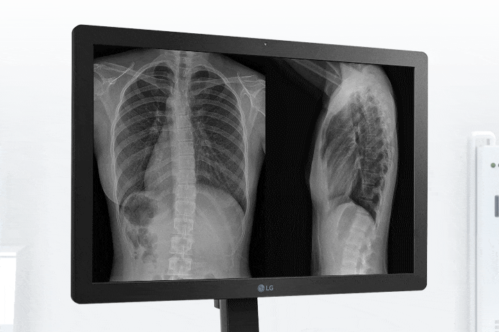 With high brightness of 600cd/m², this clinical review monitor is also suitable for diagnostic purposes.