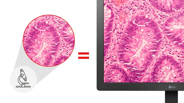 With Pathology Mode, 24HR513C provides image clarity and accuracy as if you were looking at a microscope.
