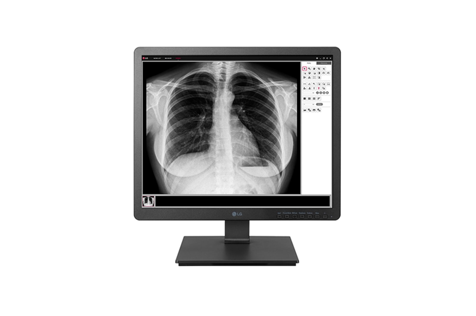 LG 19” 1.3 MP Clinical Review Medical Monitor, 19HK312C-B