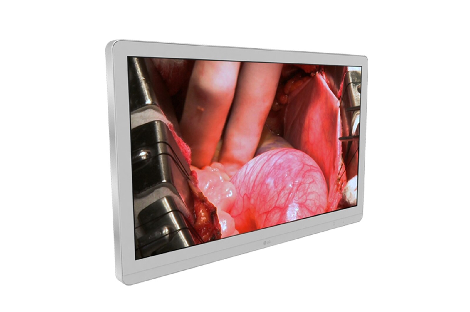 LG 27'' UHD 8MP Surgical Medical Monitor, 27HJ710S-W