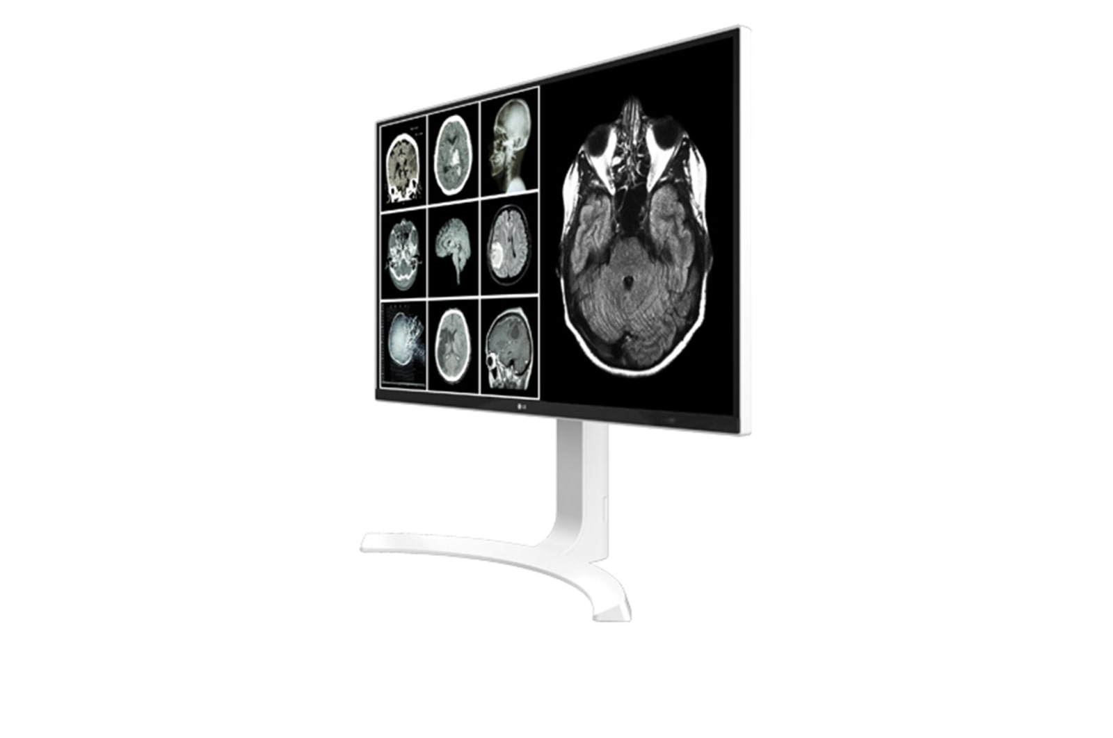 LG 27'' 8MP Clinical Review Medical Monitor, 27HJ712C-W