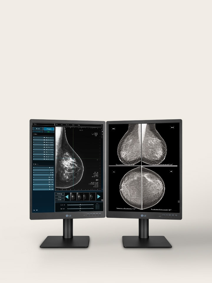 21,3"-os 5MP IPS diagnosztikai monitor.