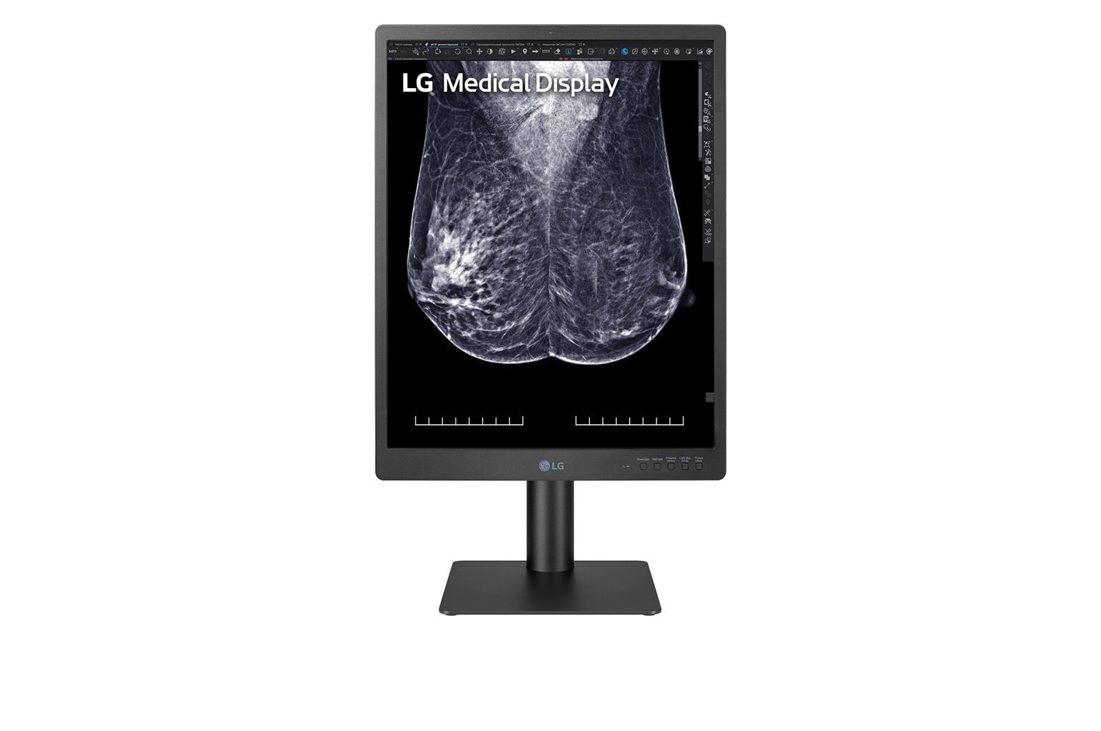 Front view of LG 21,3"-os 5MP IPS diagnosztikai monitor mammográfiához 21HQ613D-B