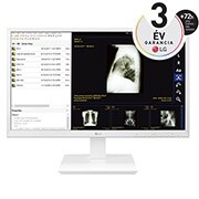 A(z) 23,8&#39;&#39; méretű All-in-One Thin Client IPS kijelző 24CK560N-3A elölnézete