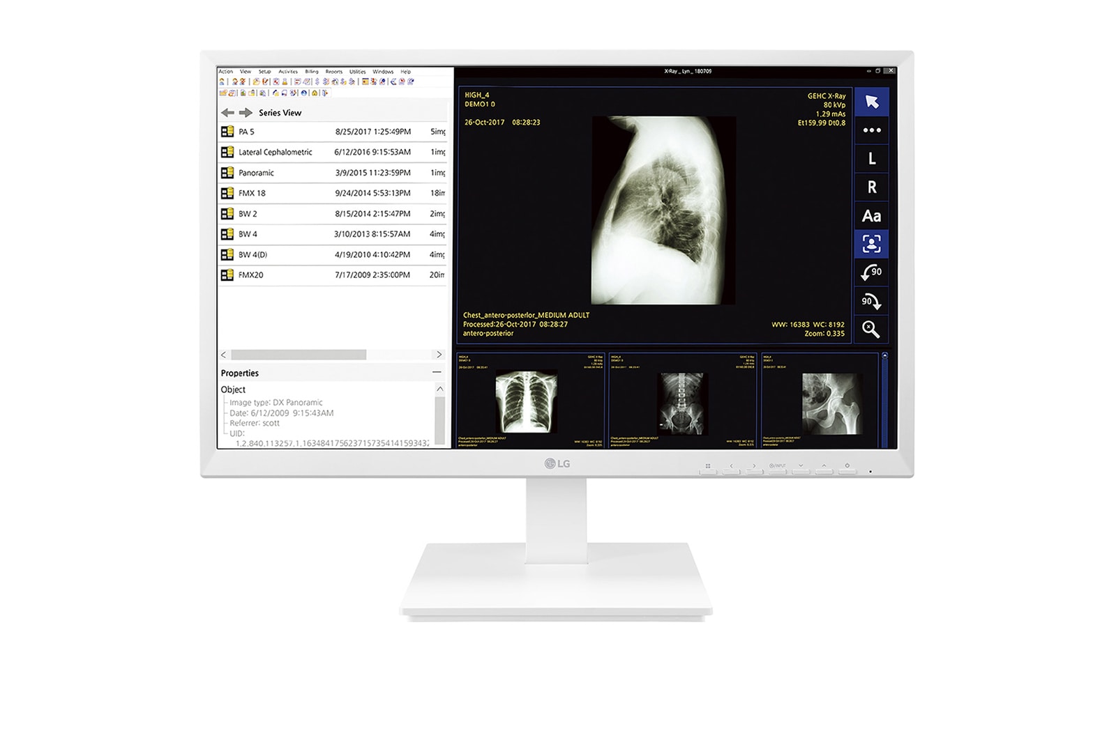 A(z) 23,8&#39;&#39; méretű All-in-One Thin Client IPS kijelző 24CK560N-3A elölnézete