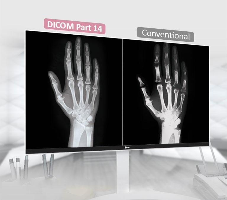 DICOM Part 14<br>1