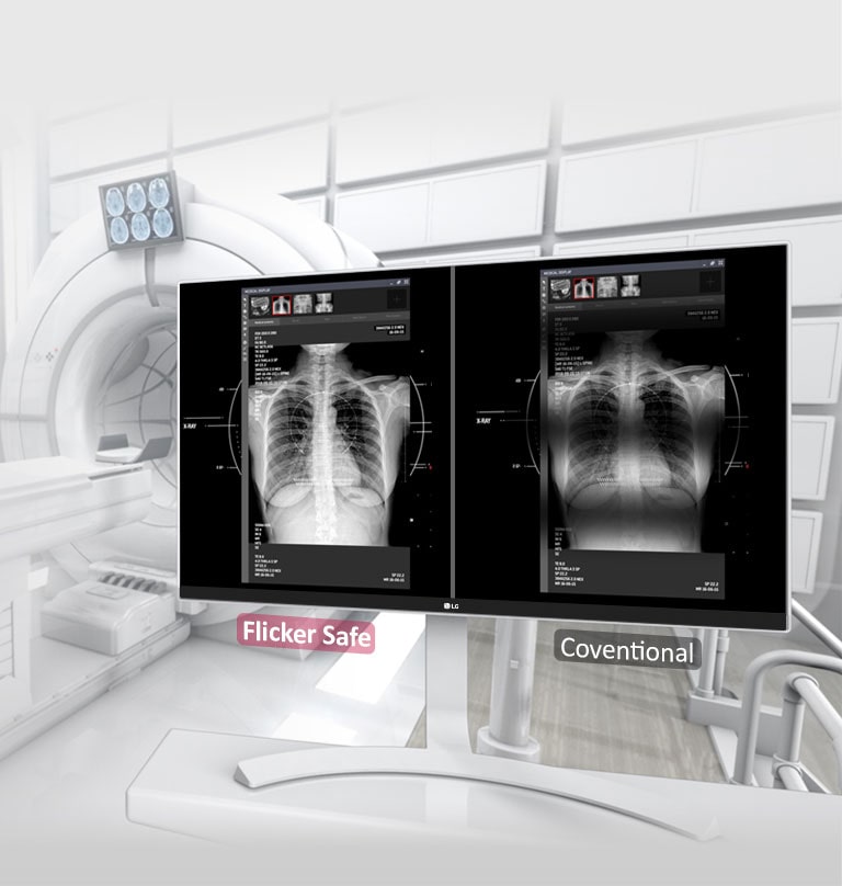 Vibrálásmentes kép1