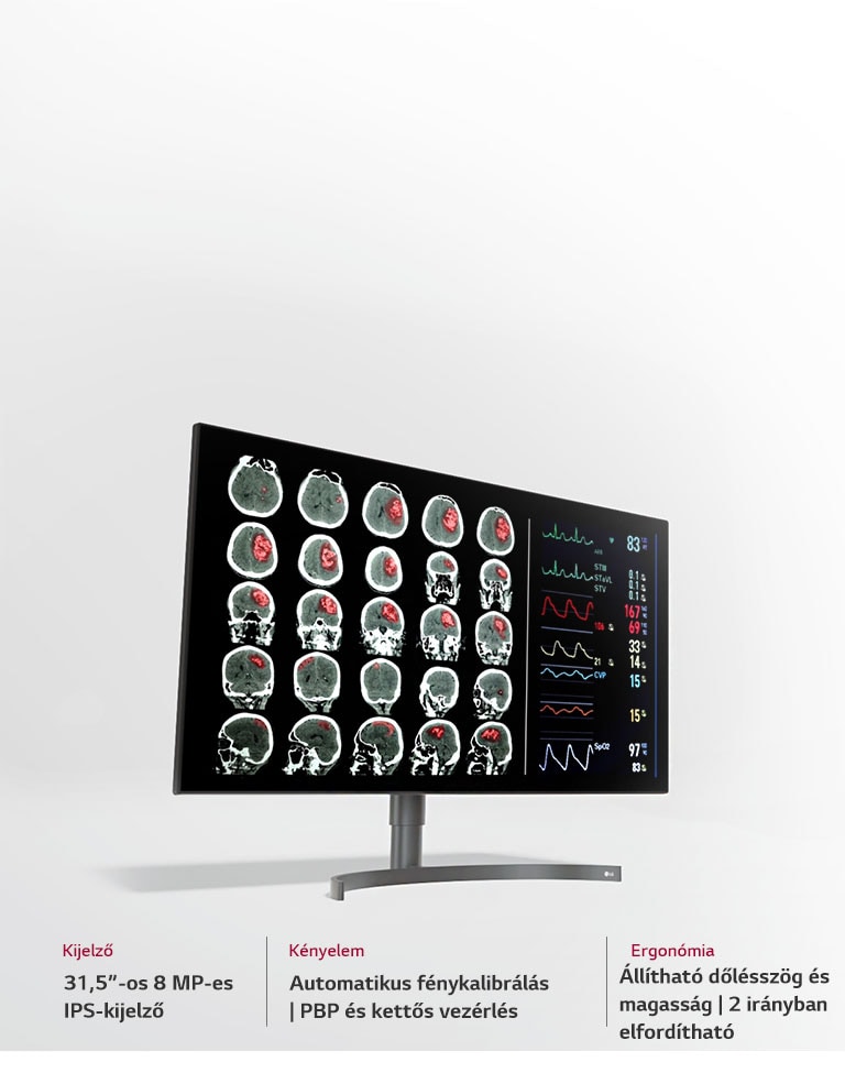 31,5”-os 8 MP-es diagnosztikai monitor3