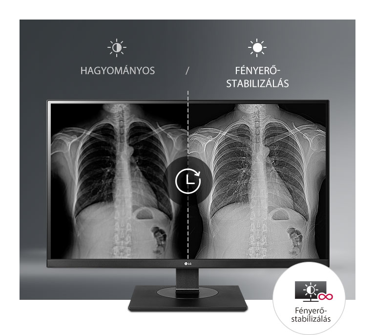 Következetesen stabil megjelenítés1