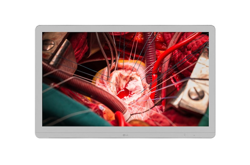 LG 27" 27HJ710S 4K & 5K UHD Orvosi monitor, 27HJ710S-W